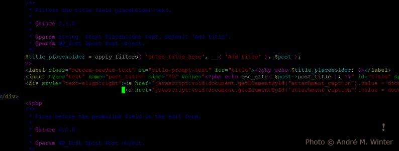 Maximize Your Calorie Burn: The Power of Interval Training’s High-Intensity Switch-Up